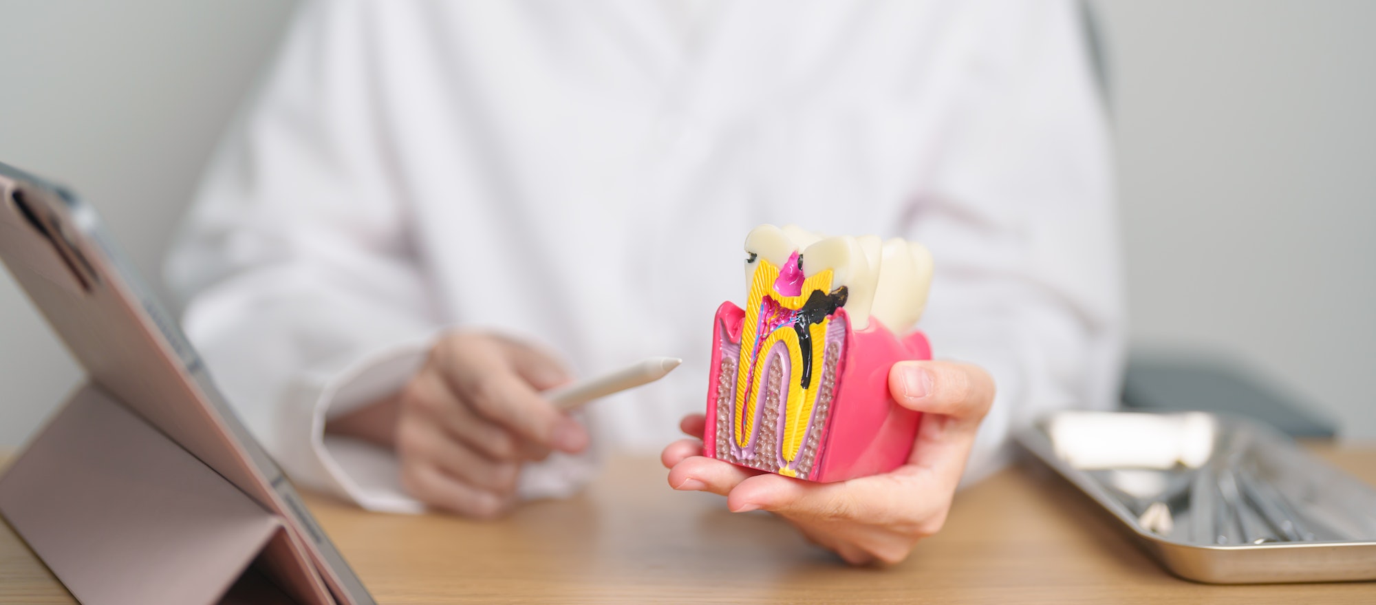 Dentist with tooth Anatomy model. Oral Teeth decay