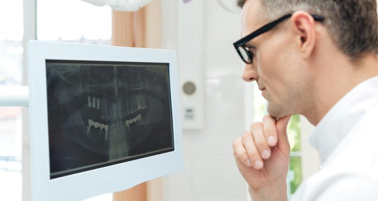 Male dentist looking teeth on digital X-Ray computer monitor