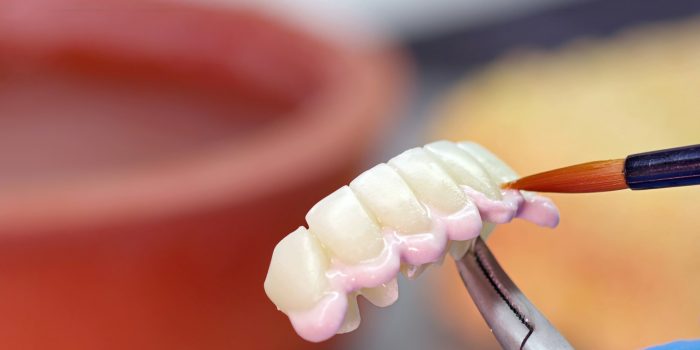 Zirconium porcelain and implant studies in the Dental Laboratory